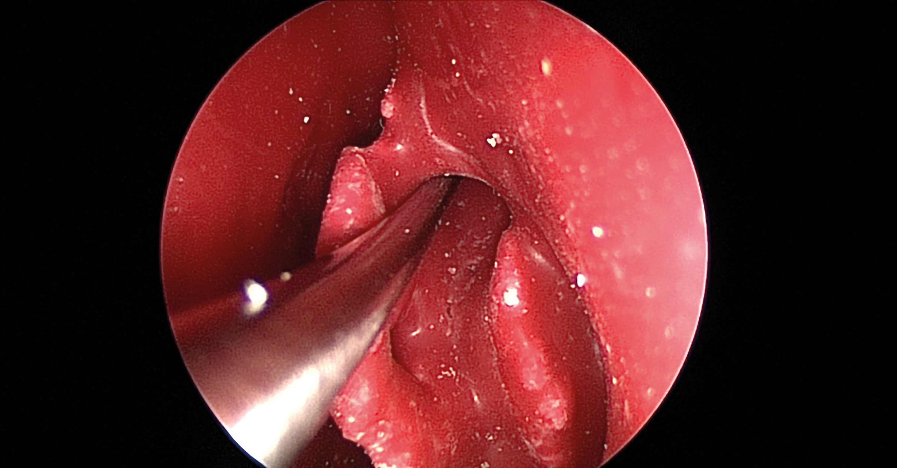 Endoscopic view without navigation