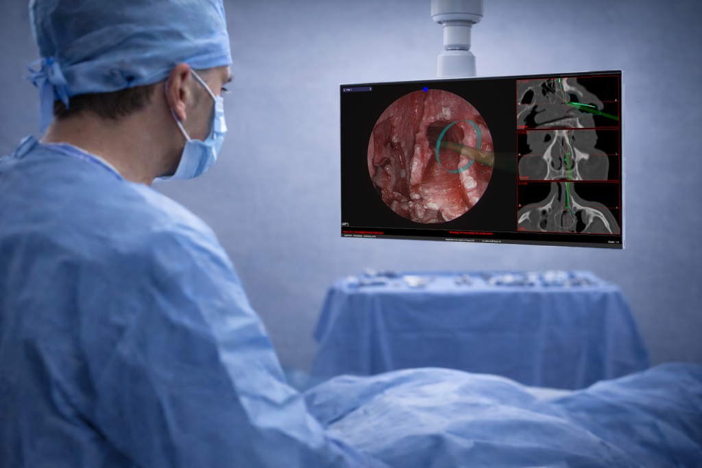 Home navi op room ai