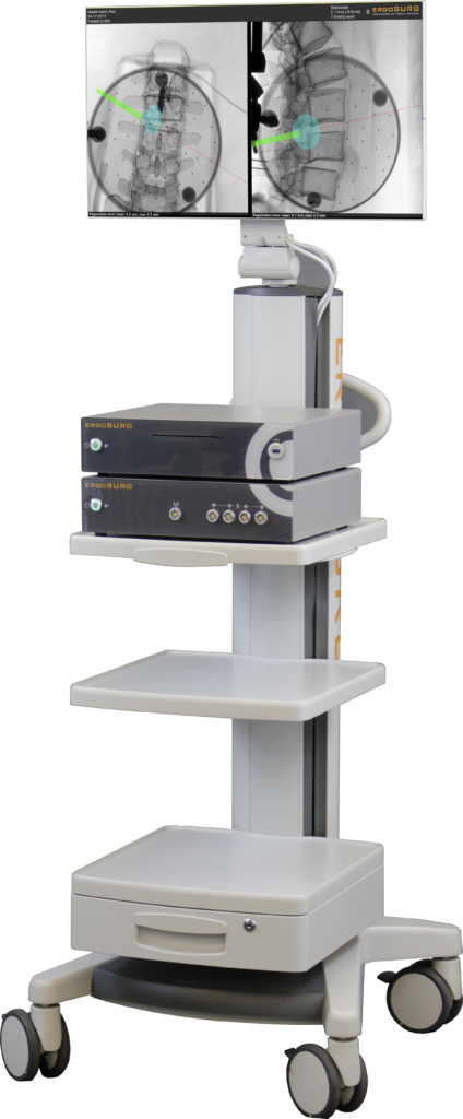 Home spine cart 2026