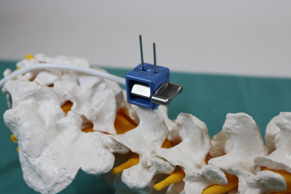 Home spine patient tracker