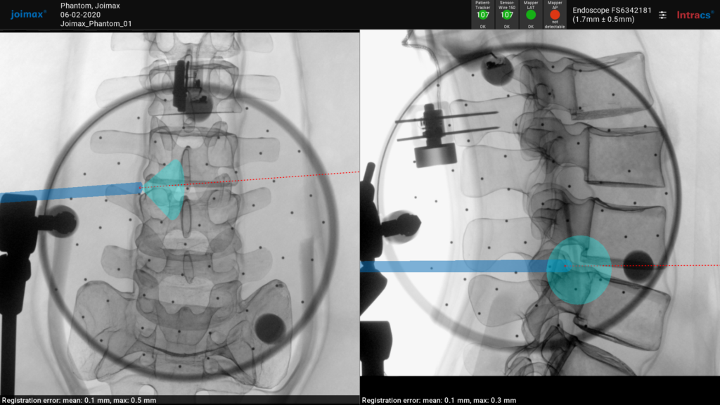 Home spine software 3