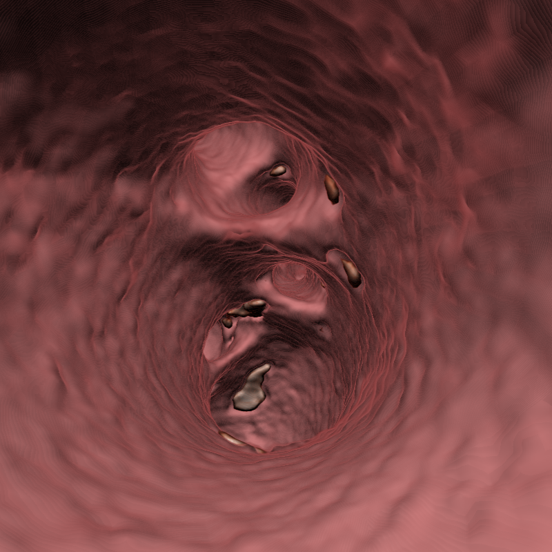 Home virtual endoscopy 002