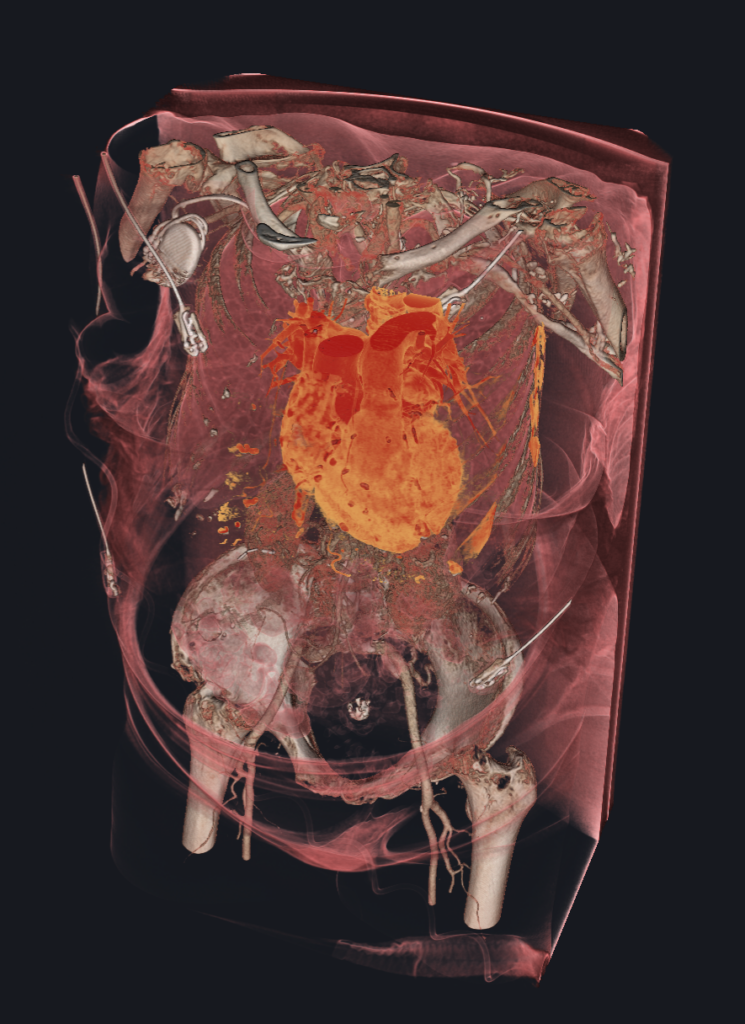 Home volume rendering 002