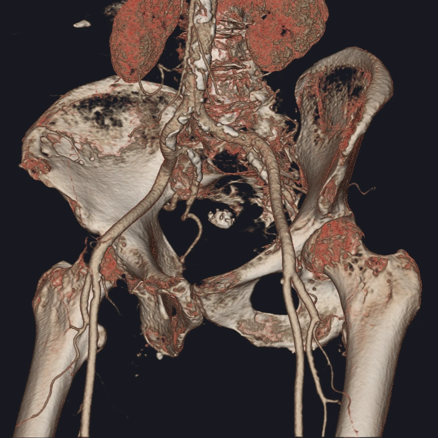 volume rendering 003